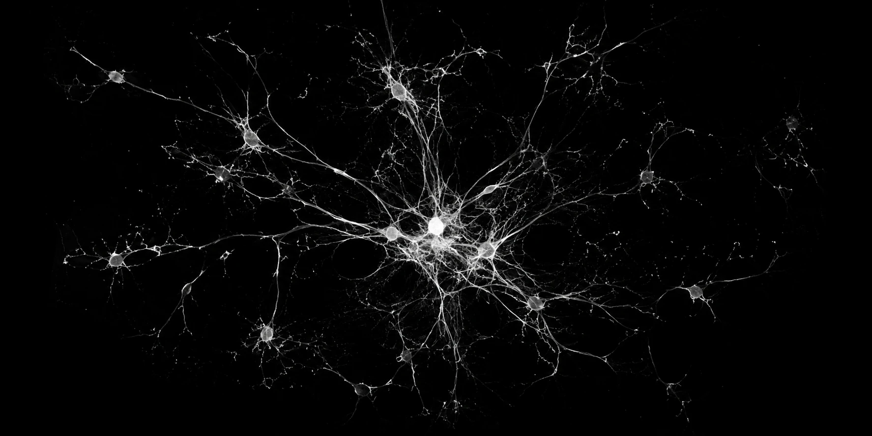 Neuronal network imaged by fluorescence microscopy